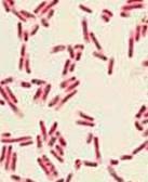 staining Gram negative Look red after staining