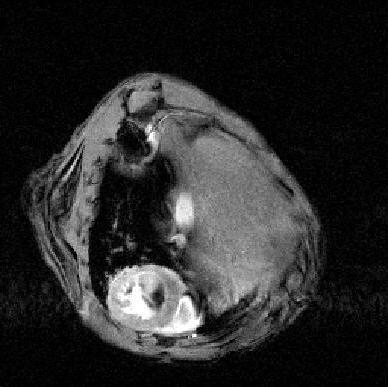 Medical imaging: MRI original image Rapid acquisition of a mouse heart beating in dynamic MRI M.E.