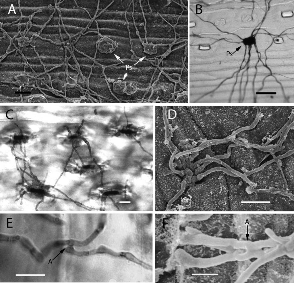STONE ET AL: PHAEOCRYPTOPUS GAEUMANNII 441 FIG. 7. Epiphytic hyphae arising from developing pseudothecia and anastomoses. A. Scanning electron micrograph of a 5 mo old needle with developing pseudothcia (Ps) and surface hyphae.