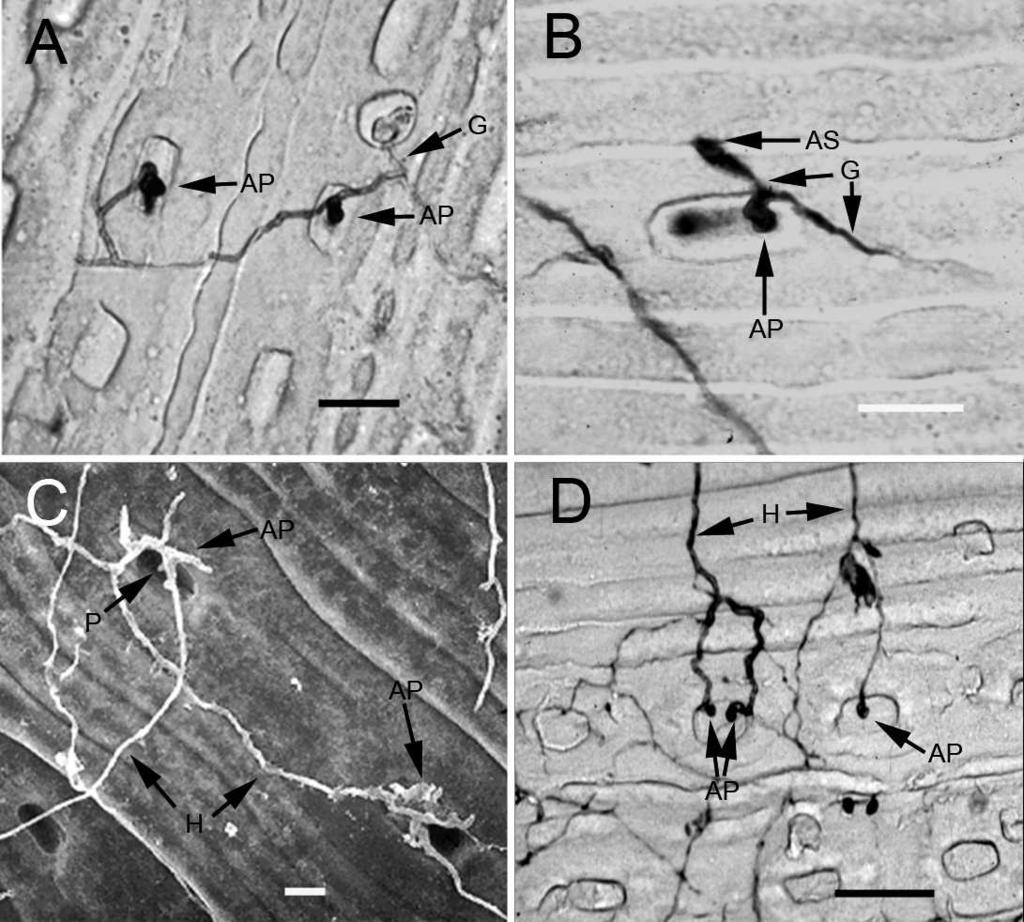 436 MYCOLOGIA FIG. 3. Ascospore germination and penetration via stomata. A, B, D, plastic surface impressions. A. Two lateral appressoria (AP) arising successively from the same germ hypha (G). B. A germinated ascospore (AS) with appressorium (AP) above a stoma, the germ hypha (G) has continued to elongate.