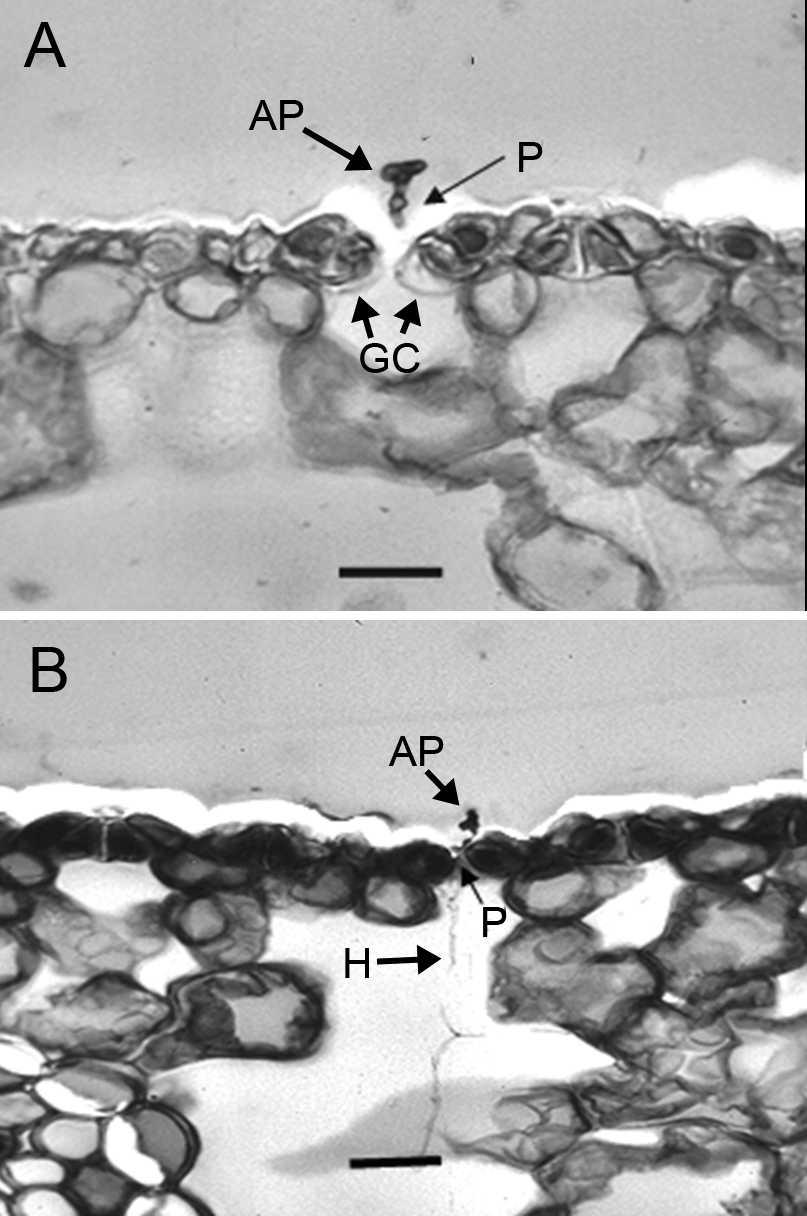 STONE ET AL: PHAEOCRYPTOPUS GAEUMANNII 437 FIG. 4. Cross sections through stomata. A. Appressorium (AP) with short penetration peg (P) growing between guard cells (GC). B.