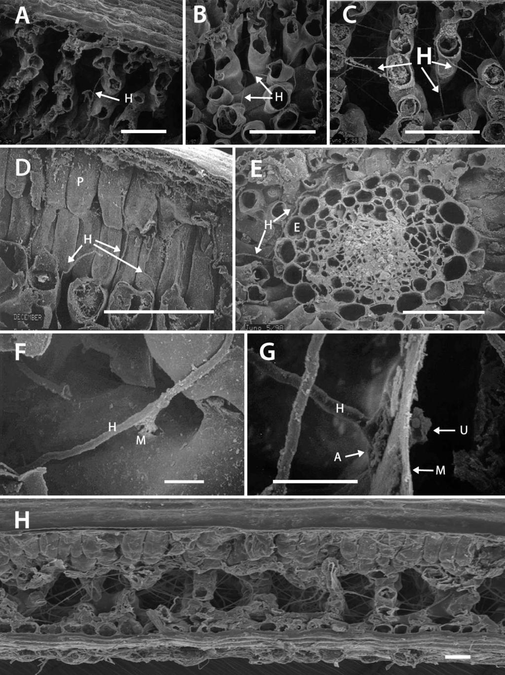 438 MYCOLOGIA FIG. 5. Scanning electron micrographs of internal needle colonization. A C. Progress of colonization 1 11 mo after exposure to inoculum. A. Colonization at 1 mo, few hyphae (H) are visible.