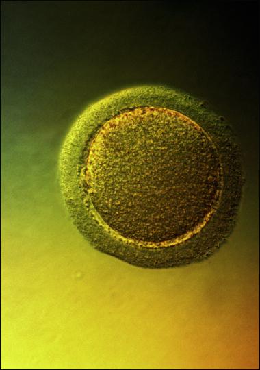 Overview of Meiosis Gametes Haploid cells