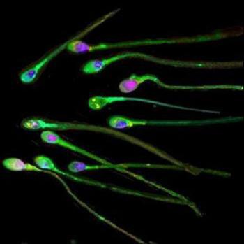 eggs Male gametes are sperm They are the