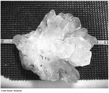 133 This giant hailstone the largest ever reported in the United States with a diameter of 17.