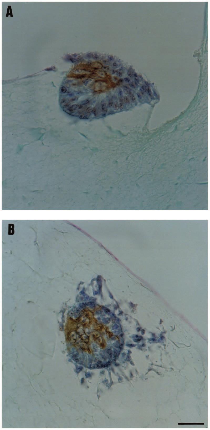 NT-3 and dermis development 2589 panels B in Figs 7 and 6).
