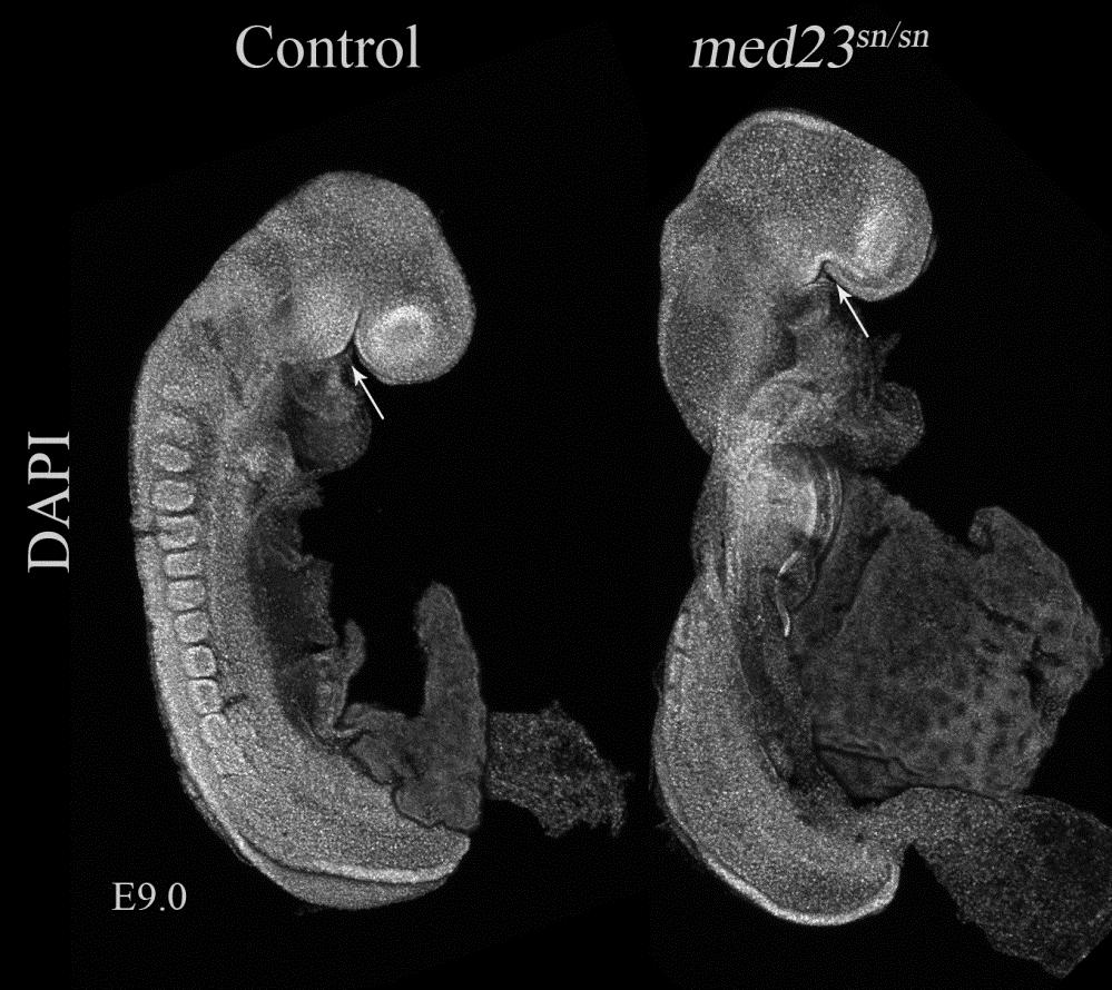 Figure 33: Craniofacial defects inmed23 sn/sn embryos are evident at E9.0.