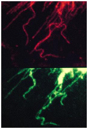 (A) The three compartment model for trafficking of VSVG- GFP. (B) VSVG-GFP-expressing cells incubated for 20 h at 40 C were shifted to 32 C and imaged every 120 s for 10 h.