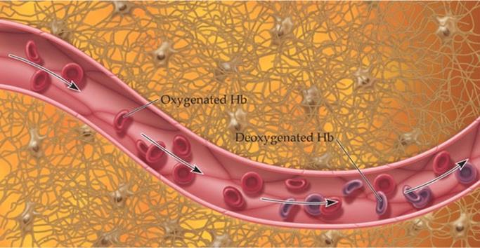 fmri magnetic field Deoxygenated Hemoglobin