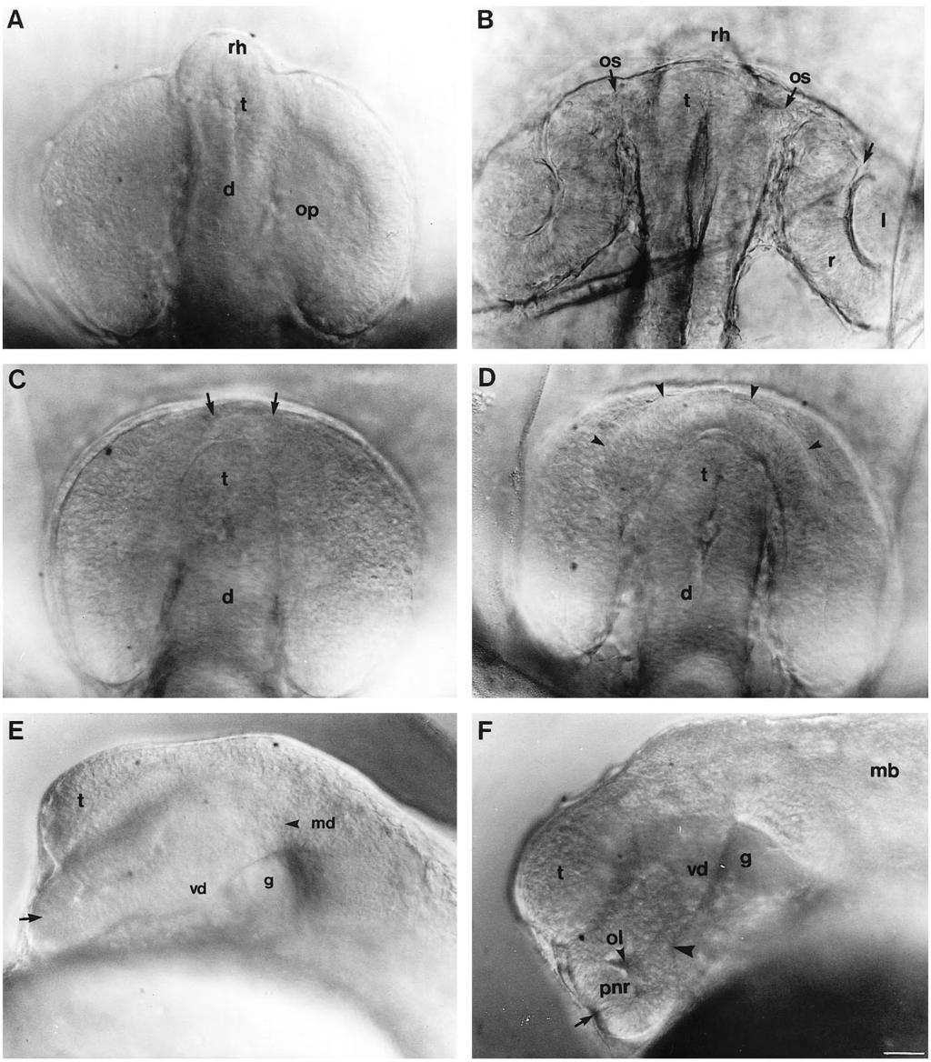 3270 R. Macdonald and others Fig. 1. Development of the eye in living wild-type embryos and embryos homozygous for the cyclops mutation. (A,B) Wildtype embryos, (C-F) cyclops embryos.