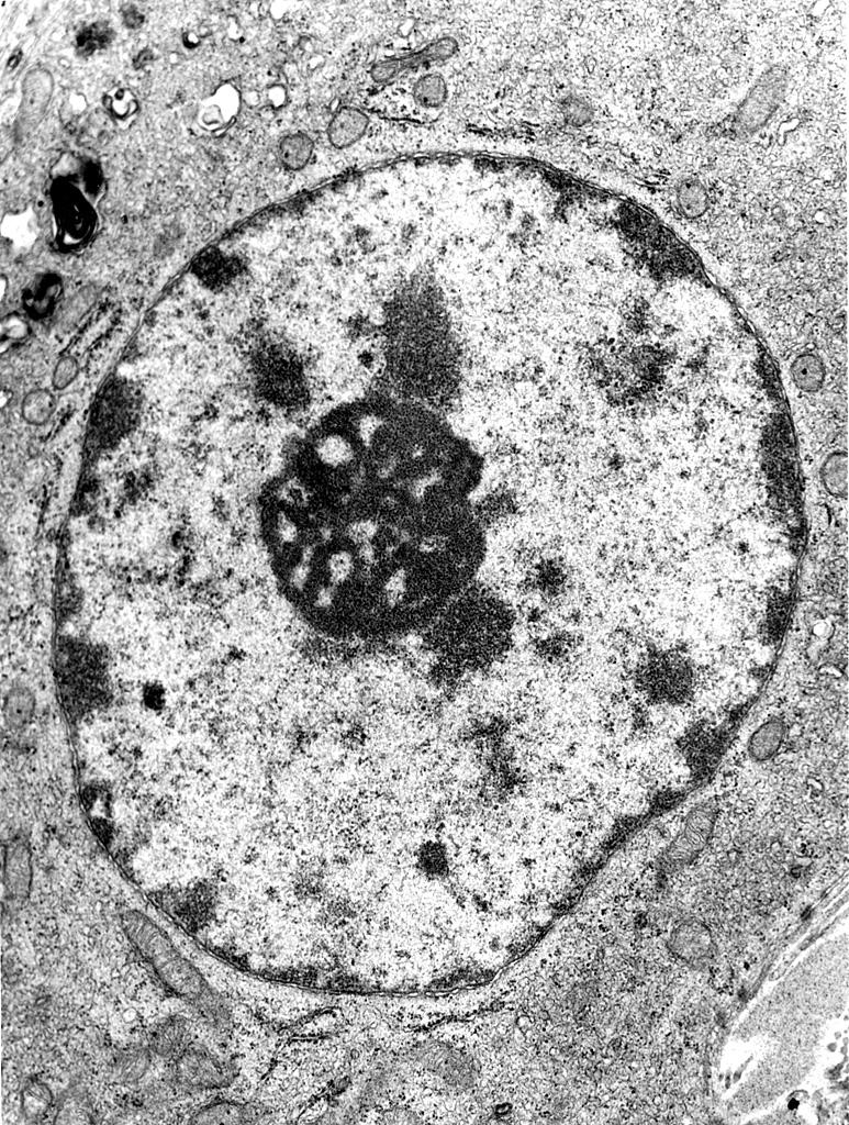 Nucleus 2 A typical nucleus