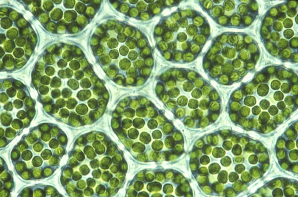 Plastids 1 Chloroplasts in leaf cells