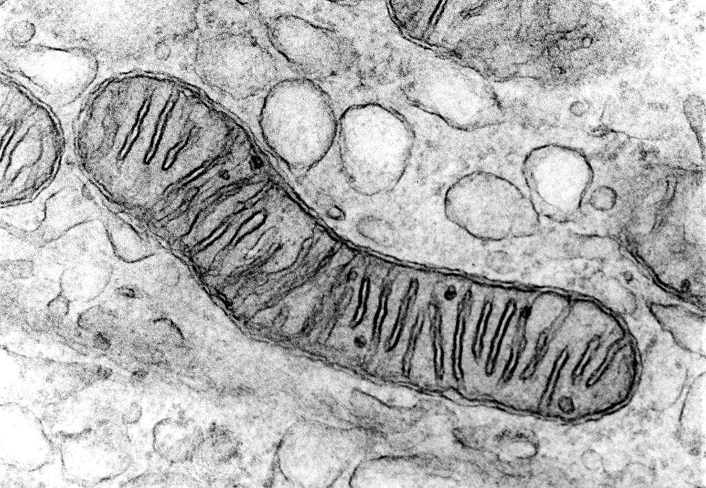 Mitochondria s from cells: mitochondria and chloroplasts Mitochondrion showing foliate cristae and matrix granules.