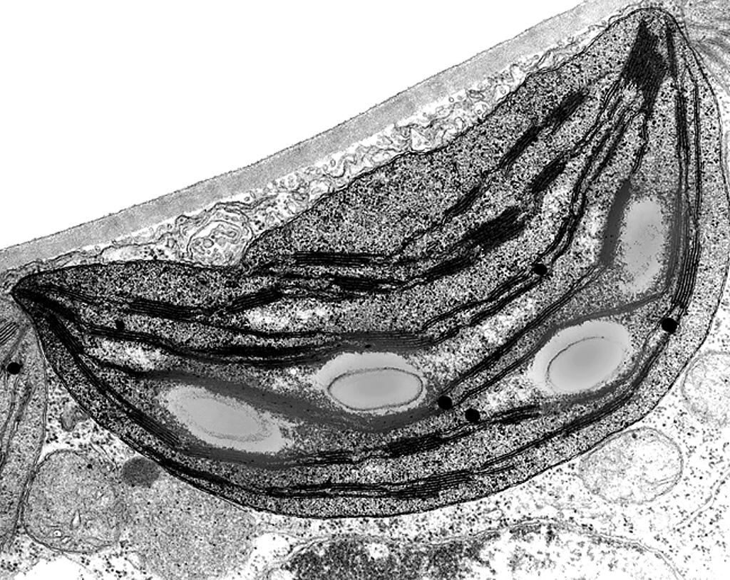 Plastid structure s from cells: mitochondria and chloroplasts Tylacoids, stroma and starch