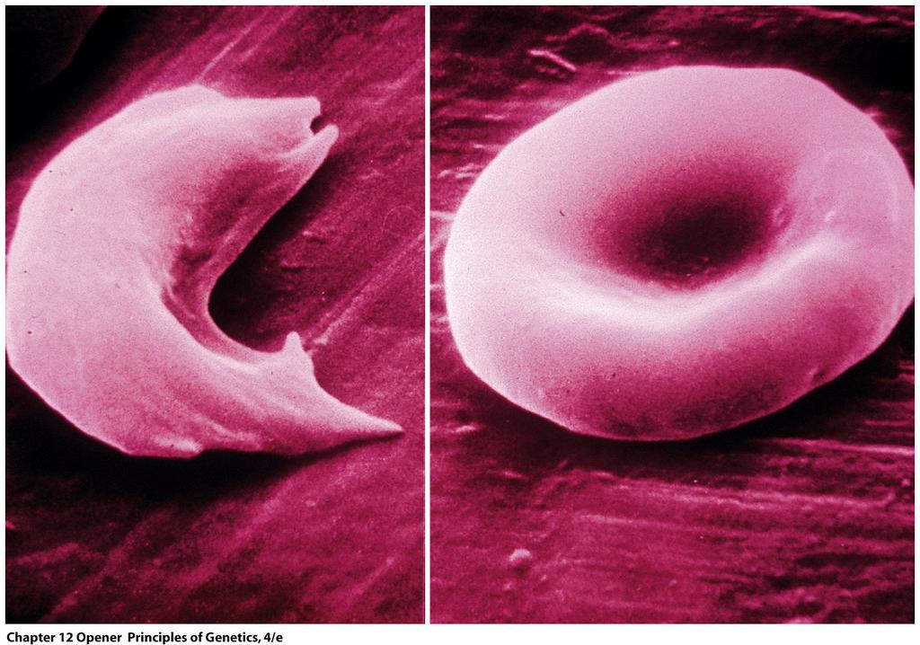 Sickle-Cell anemia: devastating effects of a single base-pair change.