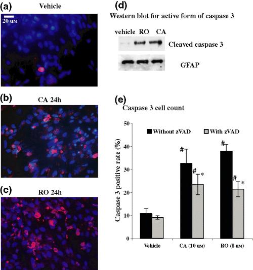 Rotenone-induced caspase 9/3-independent and -dependent cell death in undifferentiated and differentiated human neural stem cells Journal of Neurochemistry, Volume 92 Issue 3 Page 462-476, February