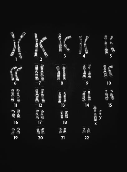 " Your cells have autosomes and sex chromosomes. Your body cells have 23 pairs of chromosomes.