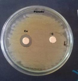 The maximum ZOI values is observed as 8mm in Escherichia coli, 10mm in Staphylococcus aureus, and 3mm in Pseudomonas aeruginosa bacteria for 50µl concentration of copper Nanoparticles as shown in the