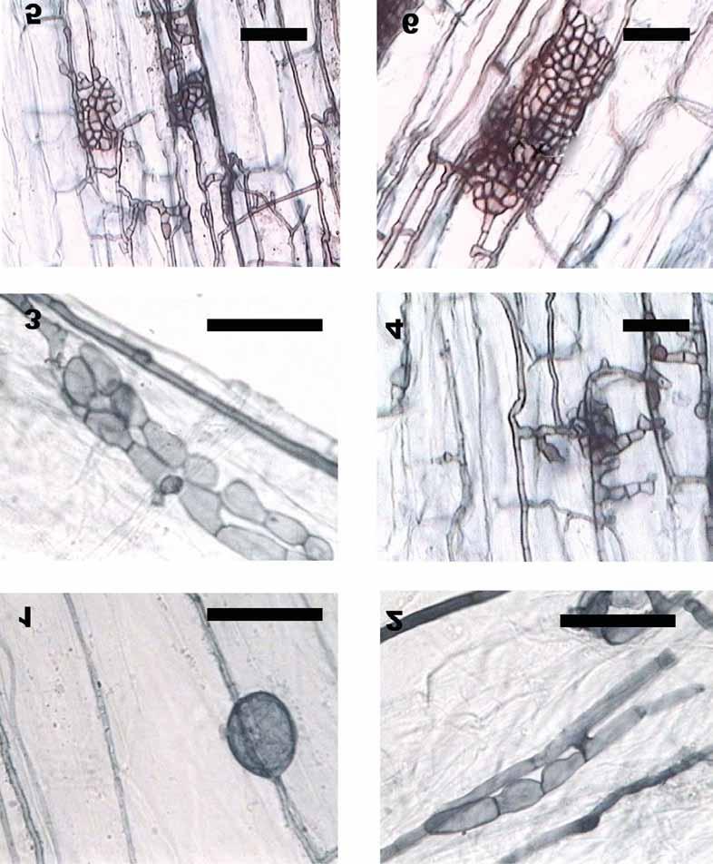 THE EVIDENCE OF MYCORRHIZAL FUNGI AND DARK SEPTATE ENDOPHYTES The samples studied also showed dark septate endophytes in the roots.