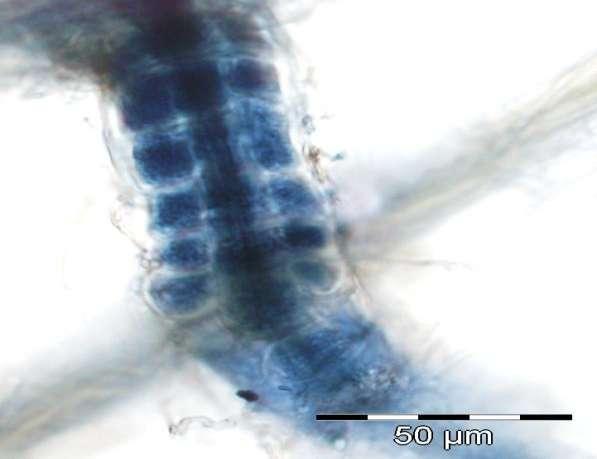 Endomycorrhizas Ericoid mycorrhizal fungi (EMF) Erica hair roots (Allsopp