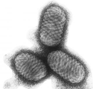 Nucleocytoplasmic large DNA virus