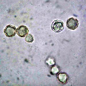 Acanthamoeba polyphaga, the host eukaryote cell Most common