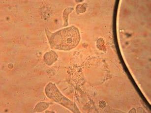 protozoa flagellate species. Eleven species of protists are known from the hindgut of R. flavipes (Lewis and Forschler 2006).