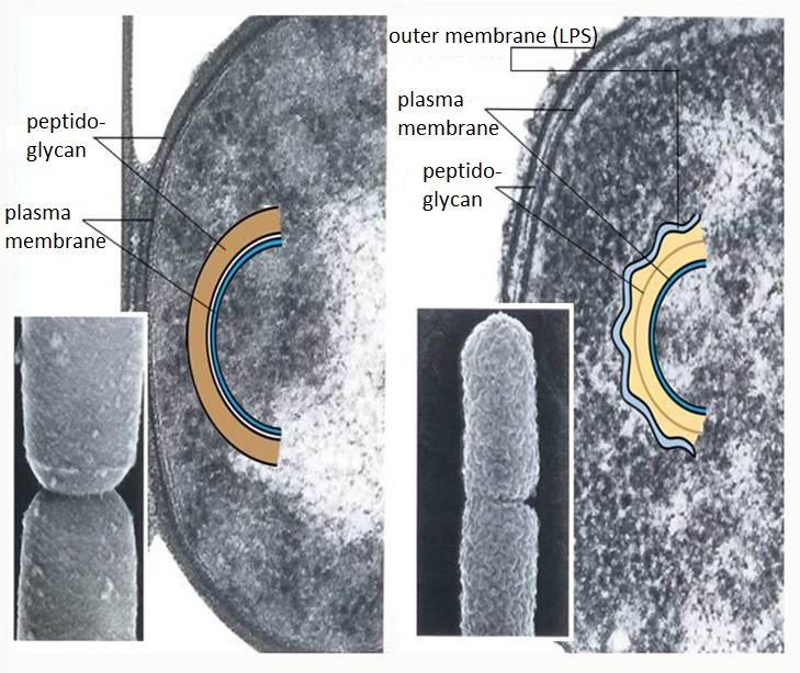 cell walls, sterols in plasma membrane