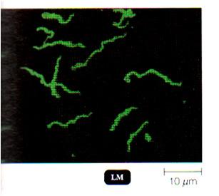 Detection of microbes compared to other light microscopy Live specimens (unstained) Stained specimens Bacteria, protozoa Live microbes: When immediate diagnosis needed When cultures aren t avail, or