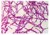 Potential -structures/distortions that appear due to prep or staining procedures NOTE: this is potential problem w/all stains Most common stain in medical microbiology Know procedure-steps,