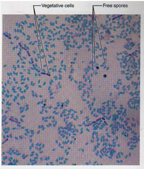 Stains; Endospore Pictures 1. Discuss vegetative vs. endospores. Free vs. still in cell. 2.
