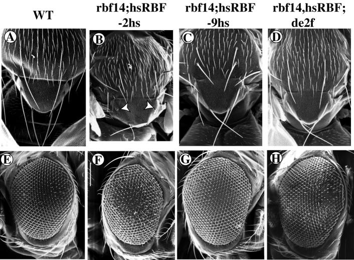 Function of RBF and de2f1 during development 371 Strikingly, in rbf 14 /Y;de2f1 164 /de2f1 91 eye discs, the pattern of PCNA expression is highly abnormal.