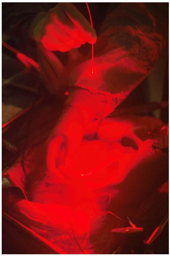 Nomenclature Modern Ligands (Porphyrin) Photodynamic Therapy(PDT) Shown is close up of surgeons' hands in an operating room with a "beam of light" traveling along fiber optics for photodynamic