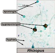 Reproductive structure: zygosporangia Rhizopus stolonifer