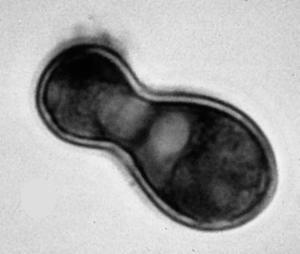 html cleistothecium Eurotiomycetes Onygenales Ajellomyces dermatitidis Yeast