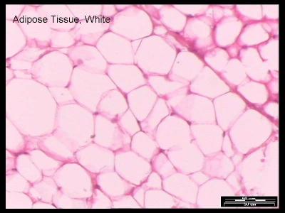 Specialized connective tissues: Adipose tissue: White adipose