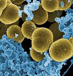 Staphylococcus aureus Has the potential to cause from benign skin infections to severe diseases, such as septicaemia, osteomyelitis and endocarditis.