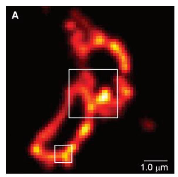 Super-resolution image Imaging Intracellular Fluorescent