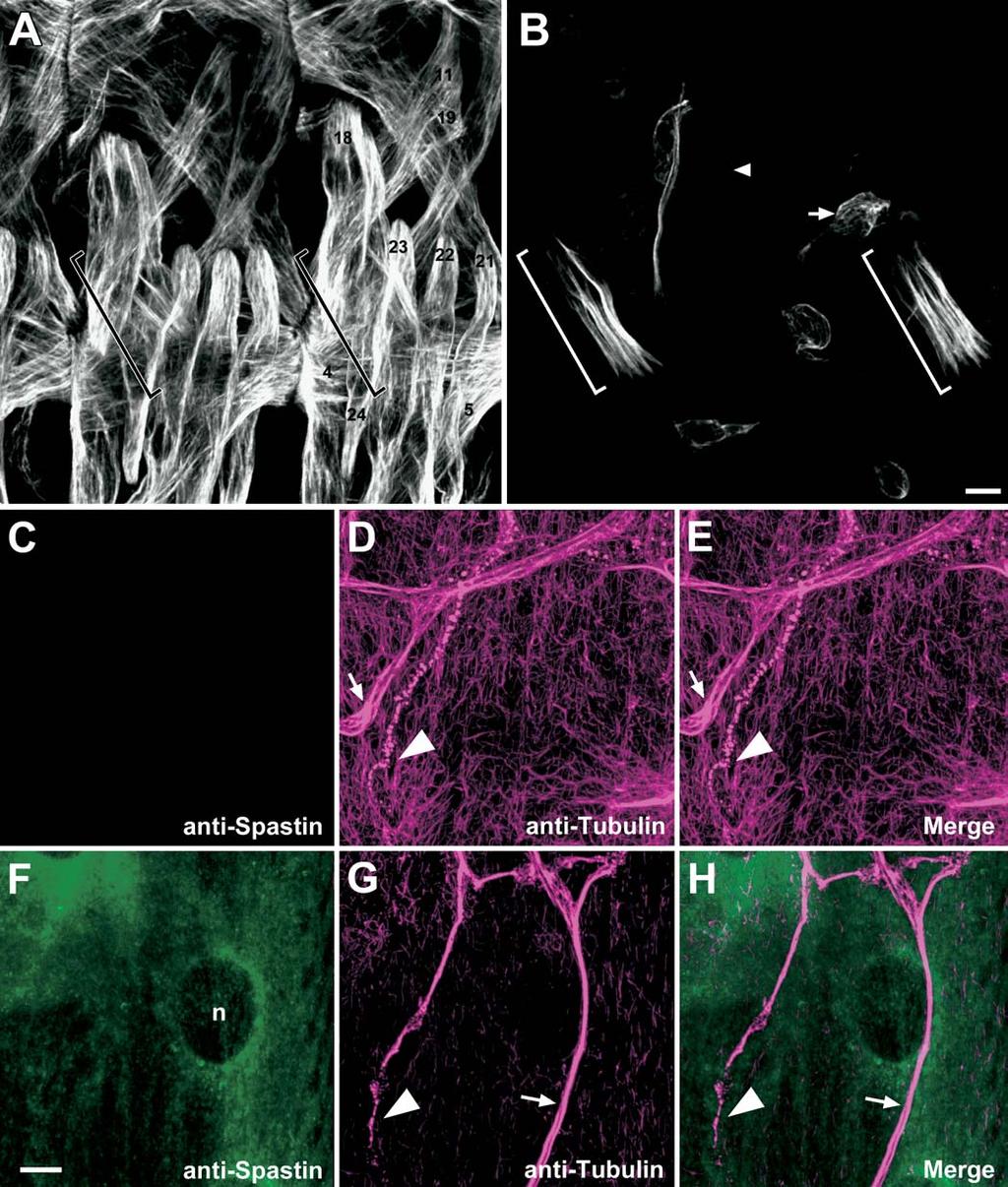 Figure 7. Spastin Overexpression in Muscles Erases the Microtubule Network (A) An antibody against b3-tubulin stains body wall muscles and chordotonal cap cells in stage 16 wild-type embryos.