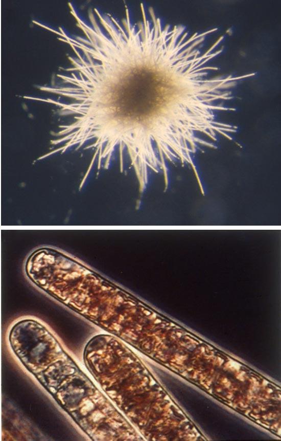 Trichodesium Filamentous cyanobacteria Nitrogen gas fixer Forms colonies and rafts Red blooms are