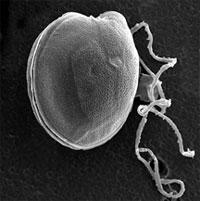 Ciguatera Fish Poisoning Toxin Ciguatera Dinoflagellates Gambierdiscus toxicus Lives attached to seaweed Transmitted to herbivorous reef fish