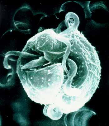 Pfisteria Dinoflagellate Pfisteria