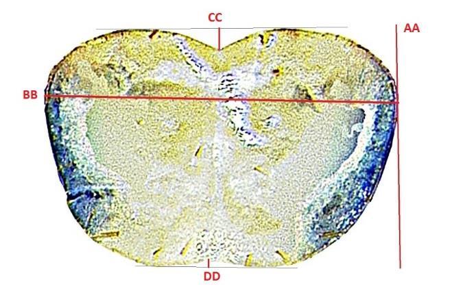 base of mandibles. Figure 2. Pronotal metrics used in this study.