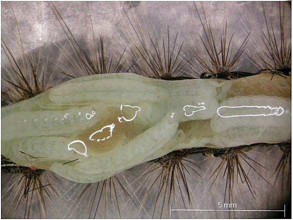 Figures 9 and 10: Euproctis chrysorrhoea larva, second-instar parasitoids in host hemocoel. 2.