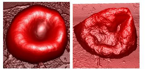 Molecular Recognition Mapping Malaria-Infected Erythrocytes AFM