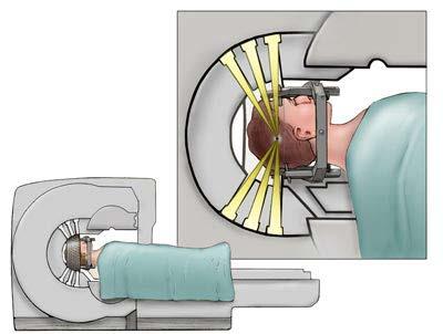 A camera such as a gamma detector or a PET scanner detects any accumulation of the tracer.