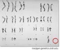 GENETICS Genetic Disorders of sex
