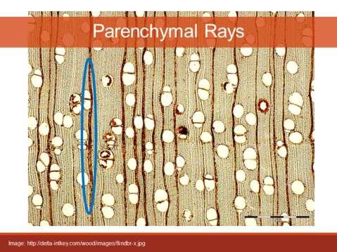 Parenchymal Rays flattened bands of tissue that extend horizontally in a radial