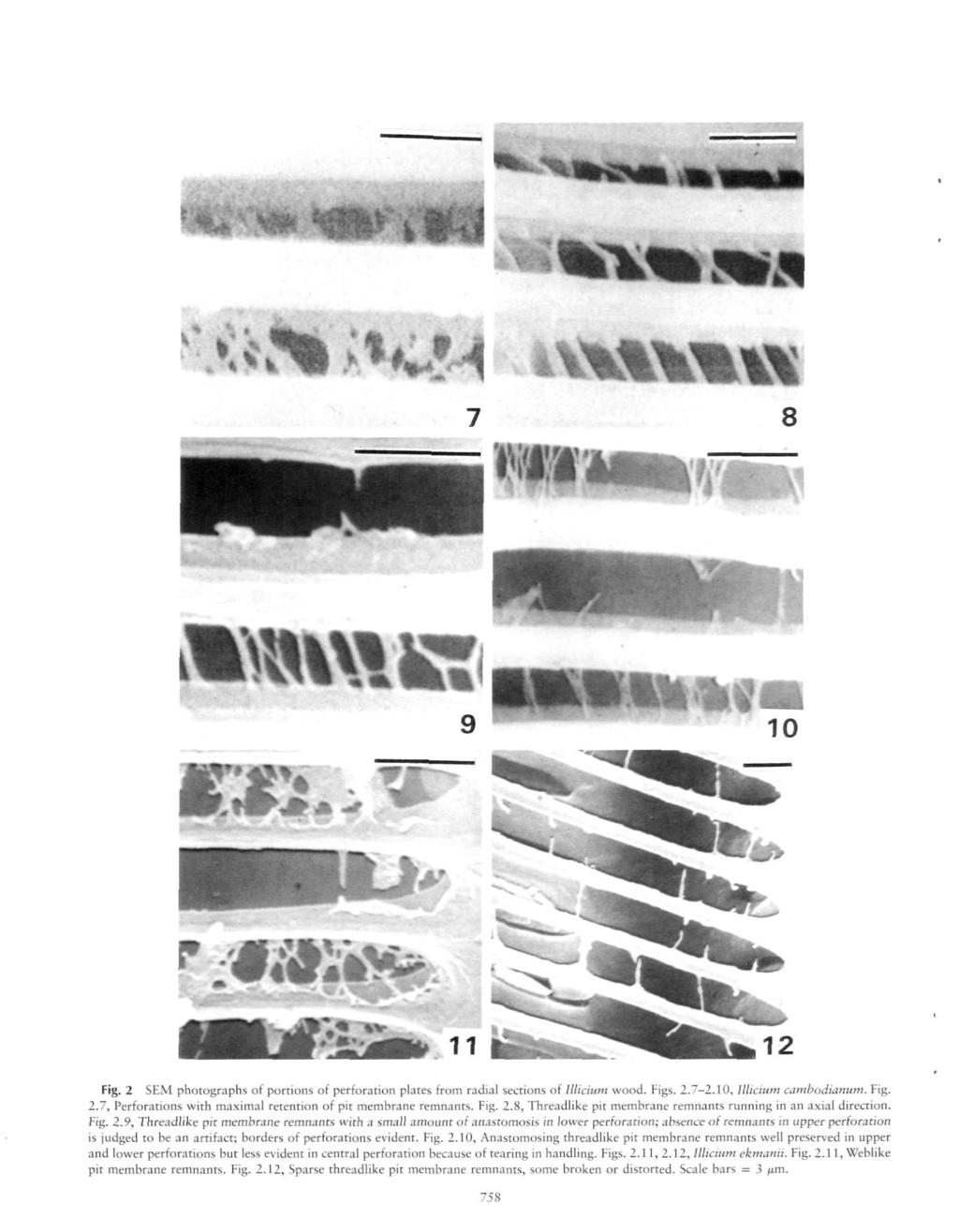 v\ fc»w\\%\\ 8 H MNtWIRi Oi* «. * # : * ^ 11 Fig. 2 SEM photographs of portions of perforation plates from radial sections of lllicium wood. Figs. 2.7-2.10, lllicium cambodianum. Fig. 2.7, Perforations with maximal retention of pit membrane remnants.