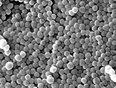 G. Schmidt-Naake et al. Figure 4: SEM image of S-co-HEMA polymer composite (HEMA content 19.8 mol%) with an average particle size of 150 nm. Arrow size is 500 nm.